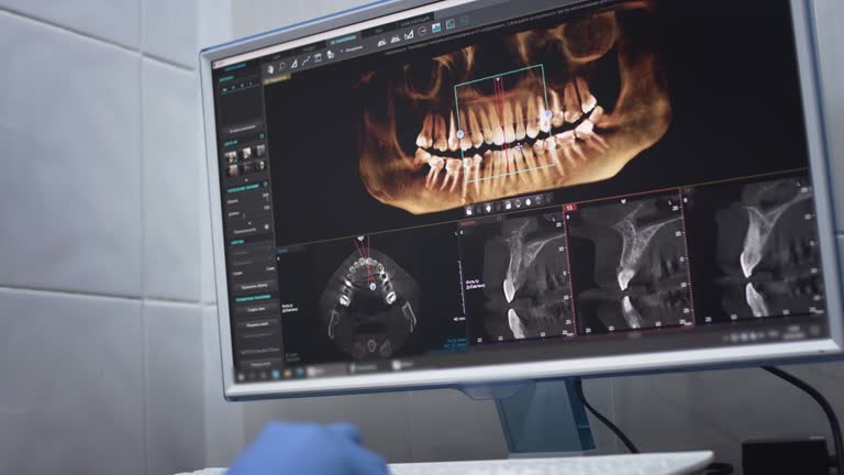 Full Mouth Reconstruction in Chandler, TX